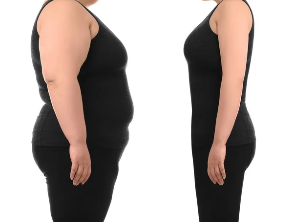 Mujer Con Sobrepeso Antes Después Pérdida Peso Sobre Fondo Blanco — Foto de Stock