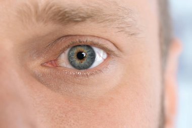 Genç adam Anti, closeup acı. Kırmızı göz