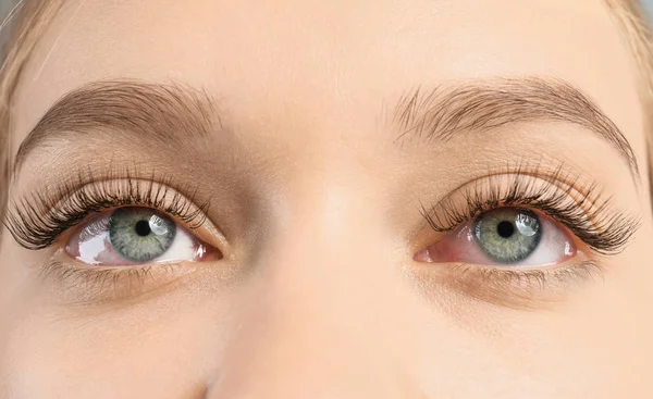 Jovem mulher que sofre de alergia, close-up. Olho vermelho — Fotografia de Stock