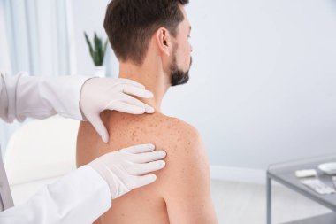 Hastanın doğum lekesi Kliniği inceleyerek dermatolog