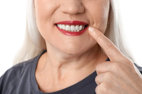 Mulher sorridente com dentes perfeitos no fundo branco, close-up — Fotografia de Stock