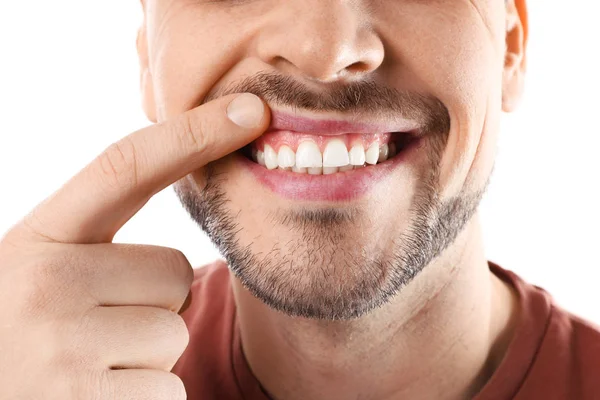 Uomo sorridente che mostra i denti su sfondo bianco, primo piano — Foto Stock