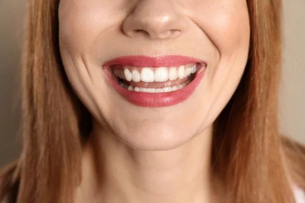Mujer sonriente con dientes perfectos sobre fondo de color, primer plano —  Fotos de Stock