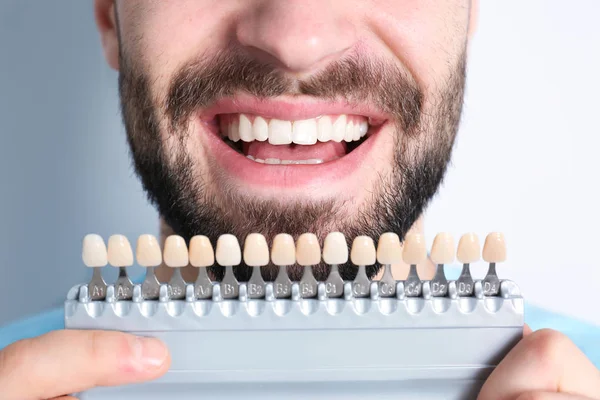 Young man with teeth color samples on light background, closeup — Stock Photo, Image