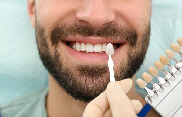Zahnarzt passend zur Zahnfarbe des jungen Mannes mit Palette, Nahaufnahme — Stockfoto