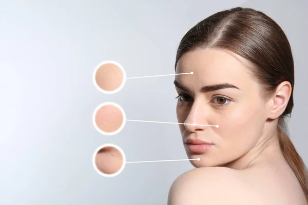 Retrato de mujer joven después de la cirugía estética sobre fondo claro. Concepto de cuidado de la piel — Foto de Stock