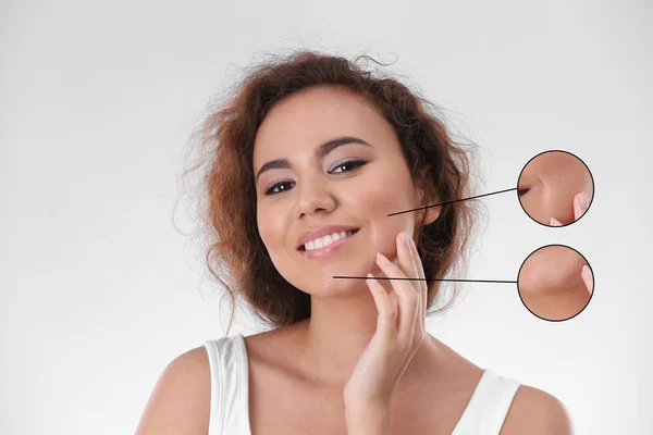 Portret van de jonge vrouw na cosmetische chirurgie op lichte achtergrond. Huidverzorging concept — Stockfoto