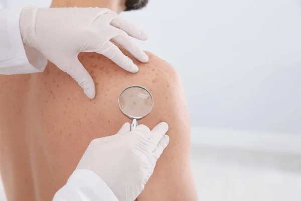 Dermatólogo examinando la marca de nacimiento del paciente con lupa en la clínica, primer plano. Espacio para texto — Foto de Stock