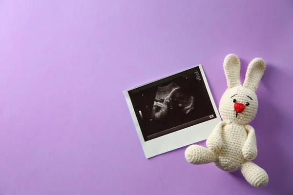 Imagem de ultra-som de bebê e coelho de brinquedo no fundo de cor, vista superior com espaço para texto — Fotografia de Stock