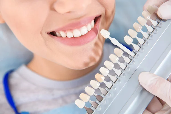 Dentista selecionando a cor dos dentes do paciente com paleta na clínica, close-up — Fotografia de Stock