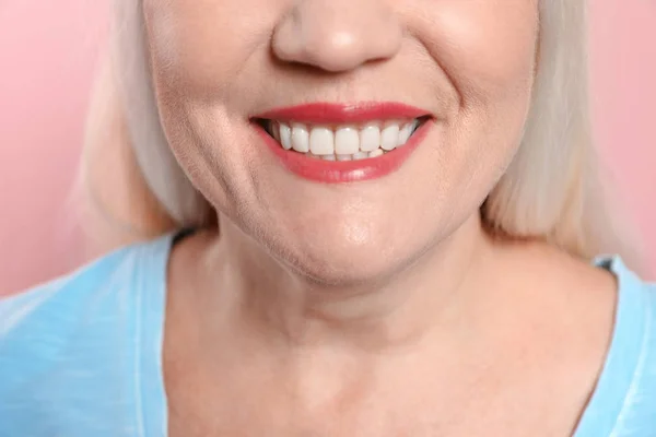 Smiling woman with perfect teeth on color background, closeup