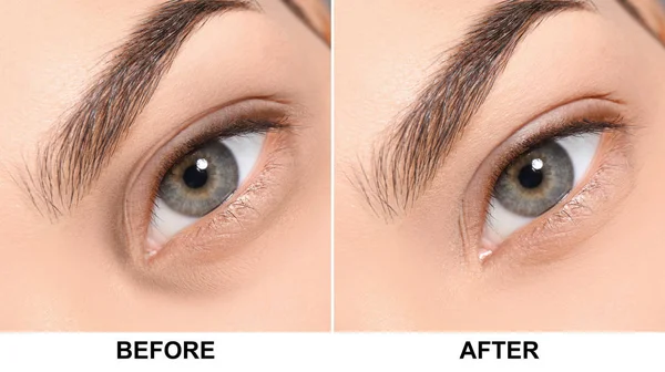 Vrouw vóór en na blepharoplastiek procedure, close-up. Cosmetische chirurgie — Stockfoto