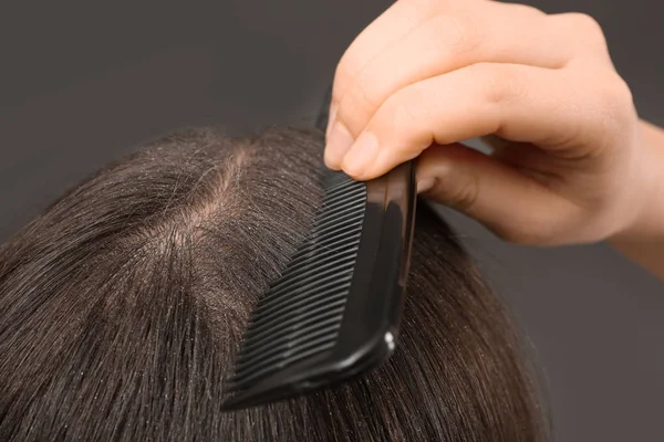 Mujer con peine y caspa en su cabello oscuro sobre fondo gris, primer plano — Foto de Stock