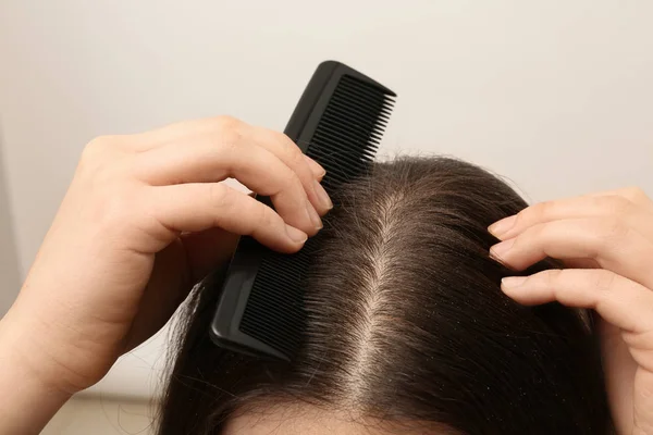 Woman with comb and dandruff in her dark hair on light background, closeup — Stock Photo, Image