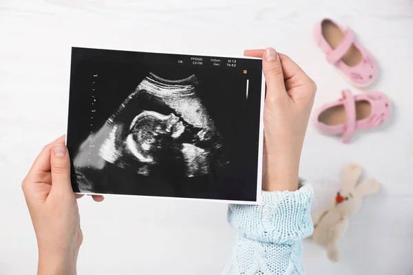 Женщина держит ультразвуковое фото ребенка за столом, вид сверху — стоковое фото