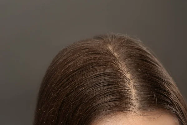 Woman with dandruff in her dark hair on grey background, closeup — Stock Photo, Image