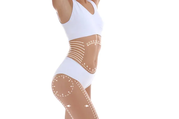 Junge Frau mit Markierungen für Lifting-Verfahren auf weißem Hintergrund. Schönheit und Körperpflege — Stockfoto