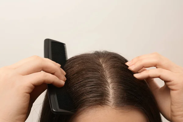 Woman with comb and dandruff in her dark hair on light background, closeup — Stock Photo, Image