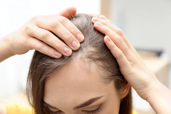 Молодая женщина с проблемой выпадения волос в помещении, крупным планом — стоковое фото