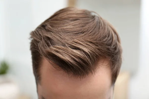 Молодий чоловік з проблемою випадіння волосся в приміщенні, крупним планом — стокове фото