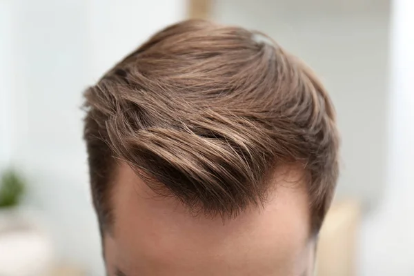 Hombre joven con problemas de pérdida de cabello en el interior, primer plano — Foto de Stock