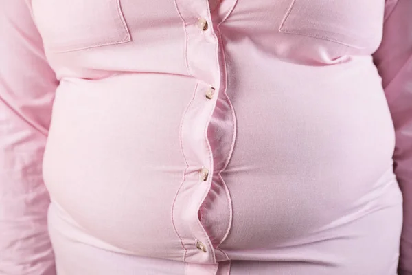 Överviktiga kvinnan i tight skjorta, närbild. Fetma och viktminskning — Stockfoto