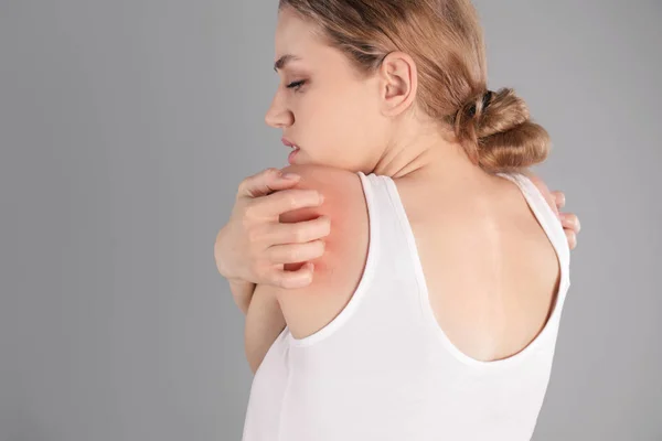 Woman scratching shoulder on grey background. Allergy symptoms — Stock Photo, Image