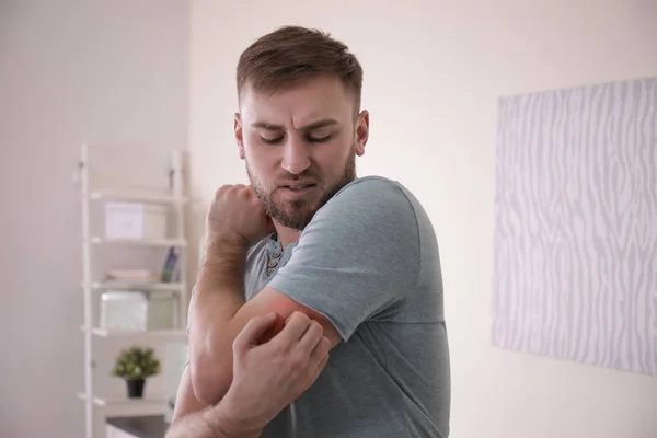 若い男が屋内で腕を掻く。アレルギー症状 — ストック写真