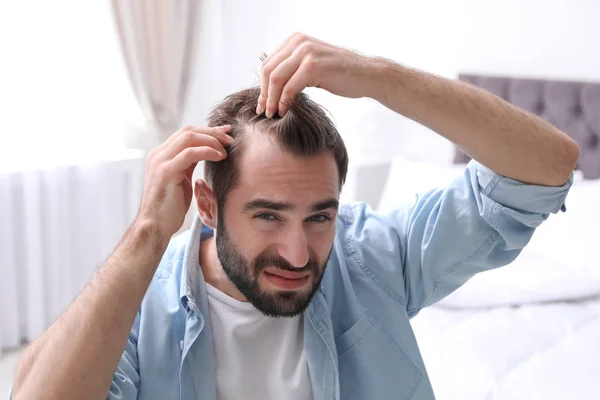Junger Mann mit Haarausfall im Haus — Stockfoto