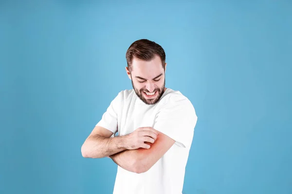 Young man scratching hand on color background. Allergies symptoms — Stock Photo, Image