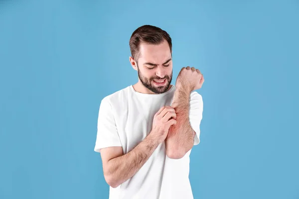 Νεαρός που ξύνει το χέρι του στο χρώμα. Συμπτώματα αλλεργιών — Φωτογραφία Αρχείου