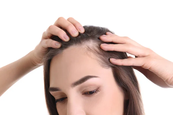 Young woman with hair loss problem on white background, closeup — Stock Photo, Image