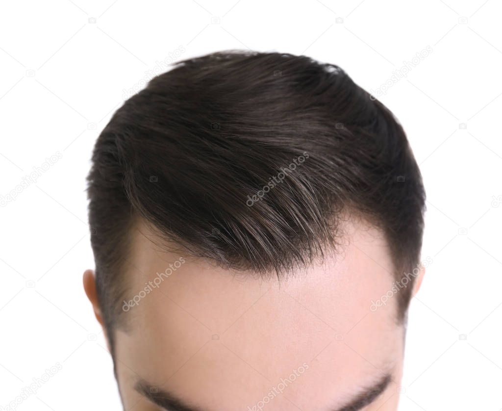 Young man with hair loss problem on white background, closeup