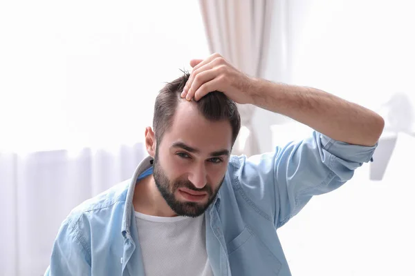 Jovem com problema de perda de cabelo dentro de casa — Fotografia de Stock