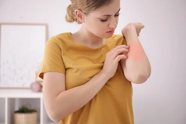 Młoda kobieta drapiąca przedramię w środku. Objawy alergii — Zdjęcie stockowe