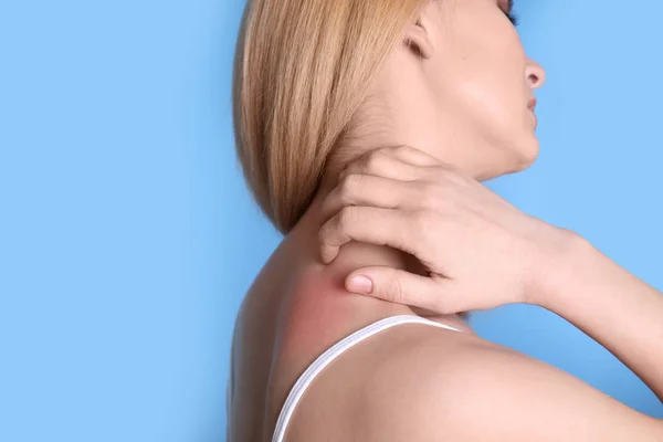 Woman with allergy symptoms scratching neck on color background, closeup. Space for text — Stock Photo, Image