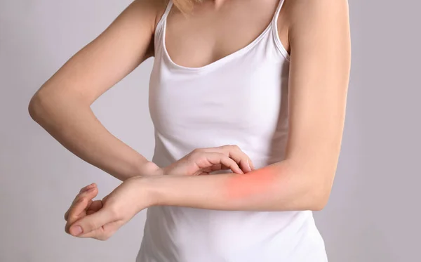 Woman with allergy symptoms scratching forearm on grey background, closeup — Stock Photo, Image