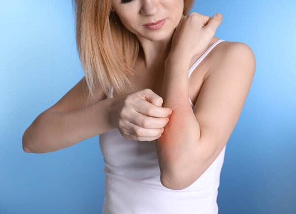 Woman with allergy symptoms scratching forearm on color background, closeup