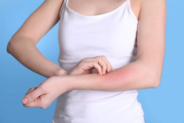 Γυναίκα με συμπτώματα αλλεργίας ξύσιμο βραχίονα στο φόντο χρώμα, closeup — Φωτογραφία Αρχείου