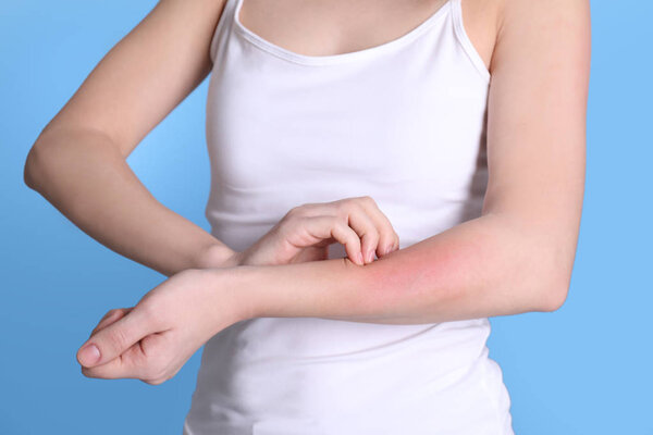 Woman with allergy symptoms scratching forearm on color background, closeup
