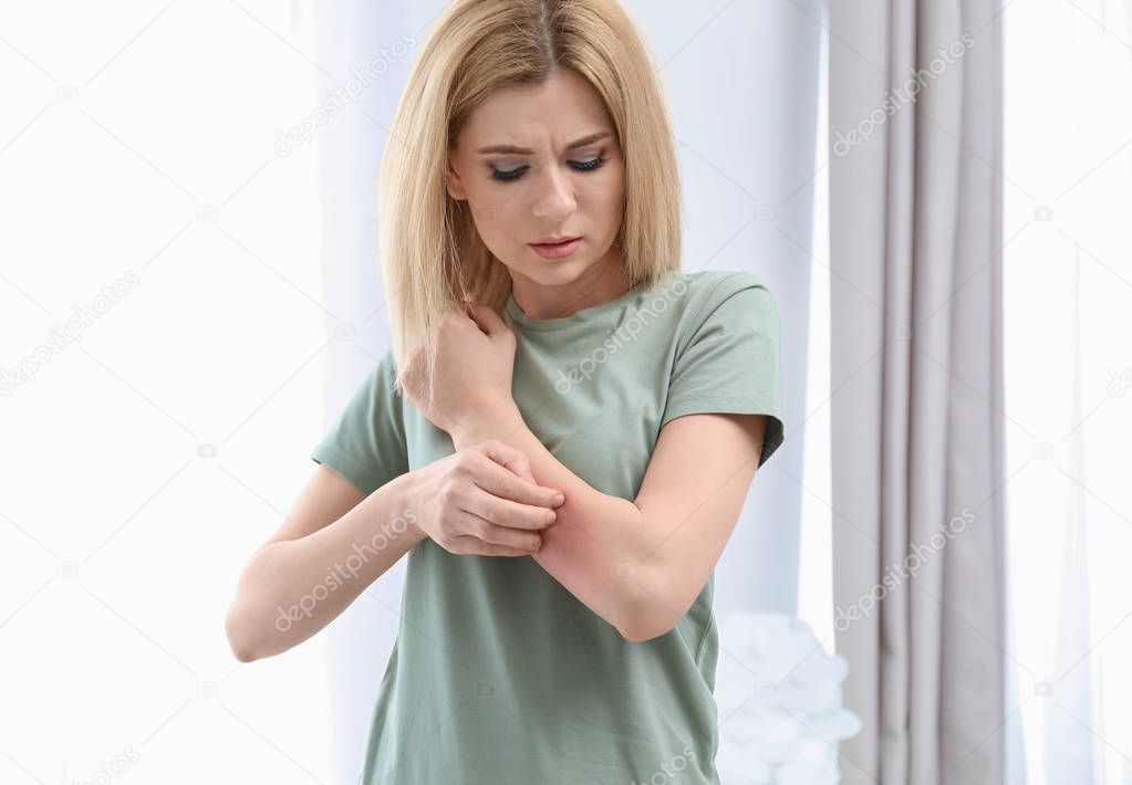 Woman with allergy symptoms scratching forearm indoors
