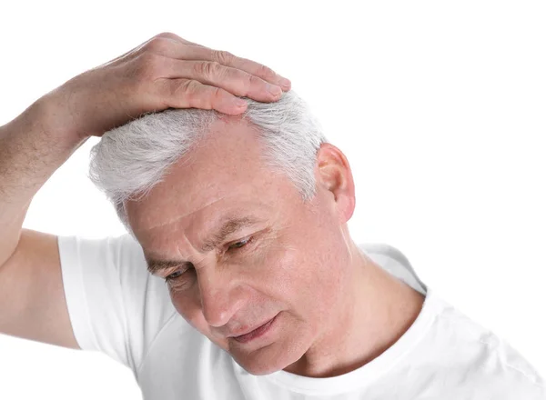 Homem sênior com problema de perda de cabelo isolado no branco — Fotografia de Stock