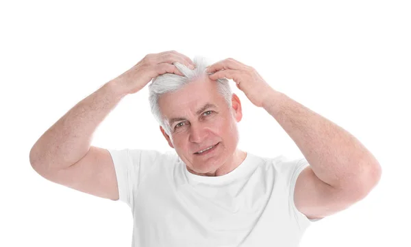 Senior Mann mit Haarausfall Problem isoliert auf weiß — Stockfoto