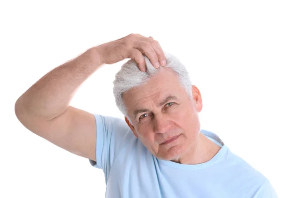 Homem sênior com problema de perda de cabelo isolado no branco — Fotografia de Stock
