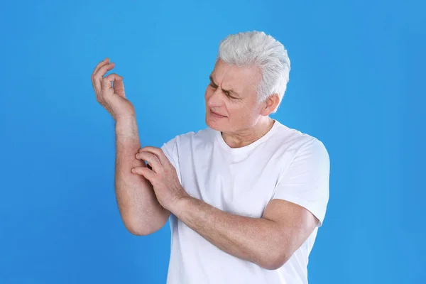 Senior man scratching forearm on color background. Allergy symptom — Stock Photo, Image