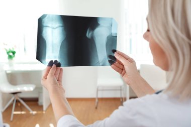 Klinikte hastanın röntgeni olan doktor. Diz sorunu