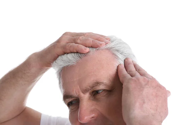 Senior Mann mit Haarausfall Problem isoliert auf weiß, Nahaufnahme — Stockfoto