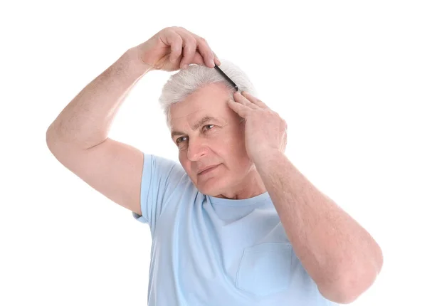 Senior Mann mit Haarausfall Problem isoliert auf weiß — Stockfoto