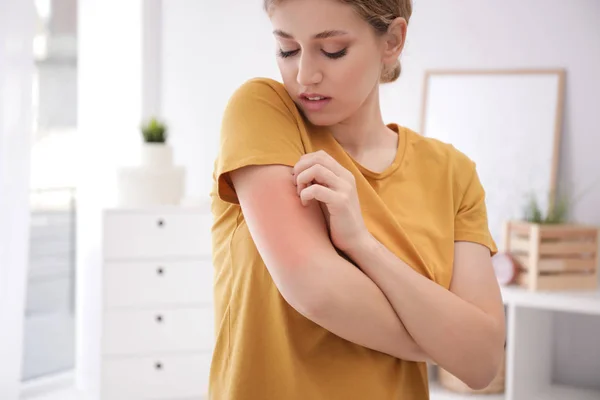 Donna che gratta il braccio al chiuso, spazio per il testo. Sintomi allergici — Foto Stock