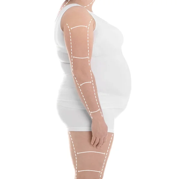 Mujer en ropa interior sobre fondo blanco, primer plano. Concepto de pérdida de peso — Foto de Stock